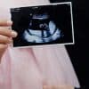 USG 4D Berapa Minggu yang Paling Ideal Ini Waktu Terbaik Menurut Dokter
